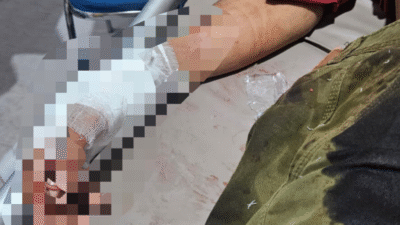 Aksi Curas Gunakan Senpi, Seorang Warga Cikalongkulon Terluka.